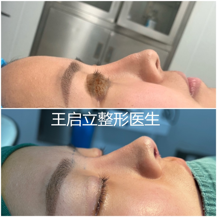 王启立医生