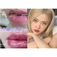 祝老师唇型案例分享