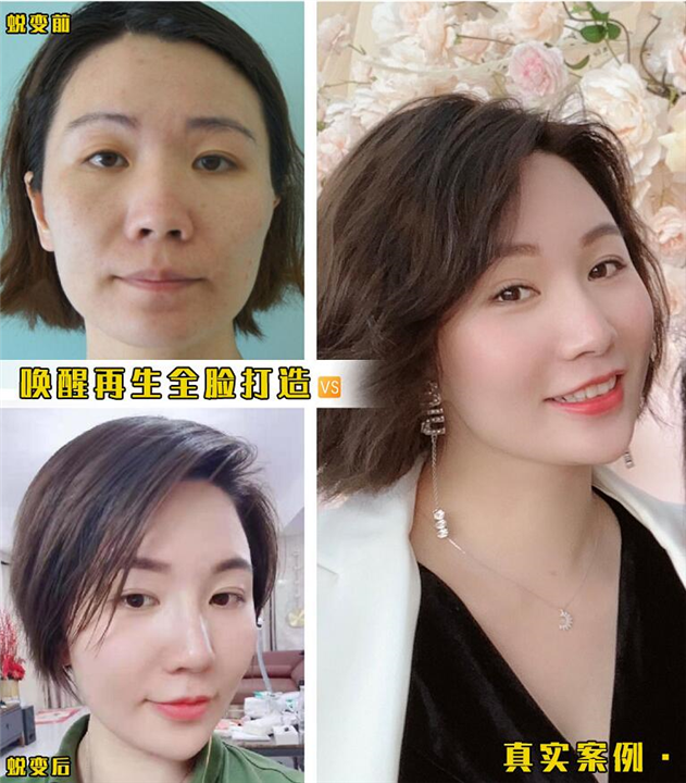北京剥离微雕