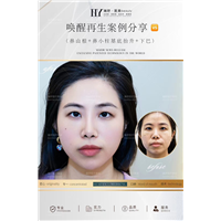 重庆剥离微整