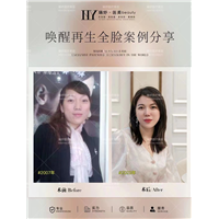 重庆唤醒再生技术