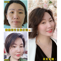 北京剥离微雕