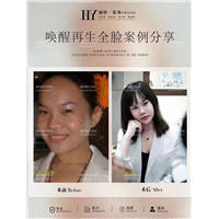 重庆唤醒再生技术