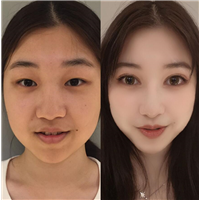 北京剥离pc美眼