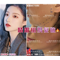 印第安纹韧带剥离价格