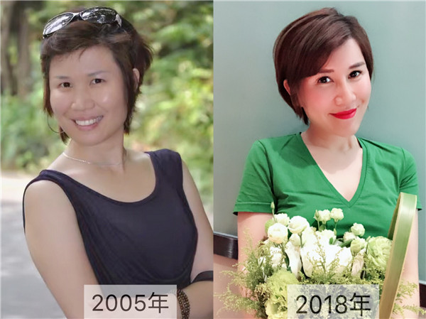 深圳剥离微整