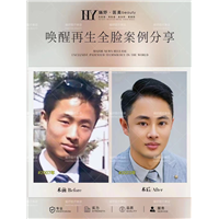 唤醒再生术