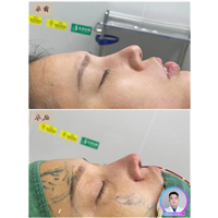 深圳鼻整形医生