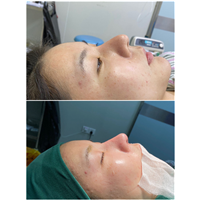 深圳鼻整形修复专家秦广安