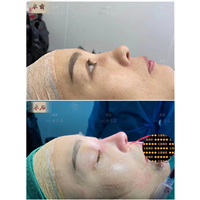 深圳鼻综合整形专家