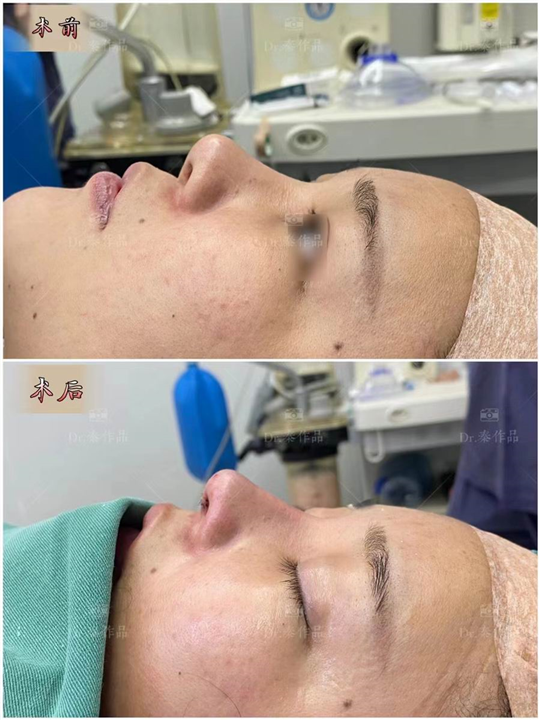 深圳鼻整形医生