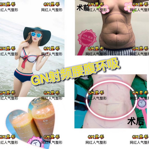 快手网红整形医院|上海抖音网红整形医院