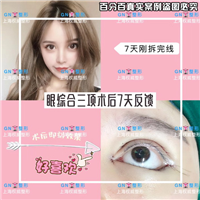 上海GN整形|GN网红整形医院