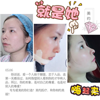 抖音上海整形医院|抖音医院网红