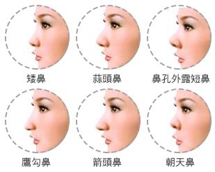 上海芭比童颜整形|上海正规网红排名