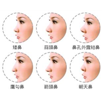 上海芭比童颜整形|上海正规网红排名
