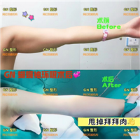 上海GN整形|GN网红整形医院