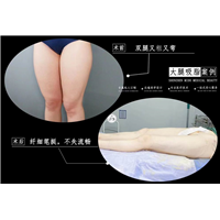 詹娜芝