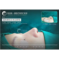 深圳超肋鼻综合整形