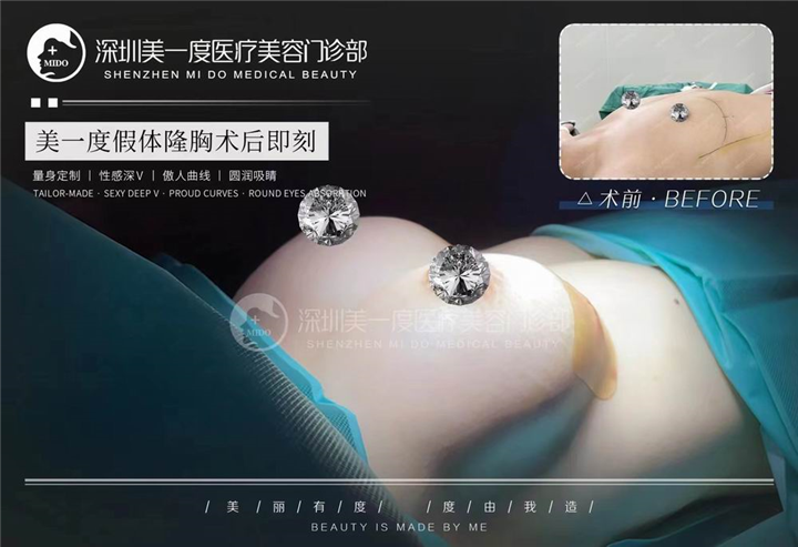 深圳星美度整形