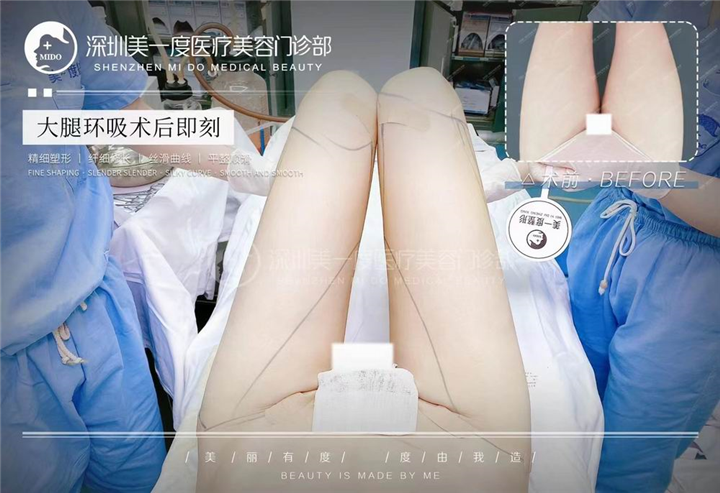 詹娜芝