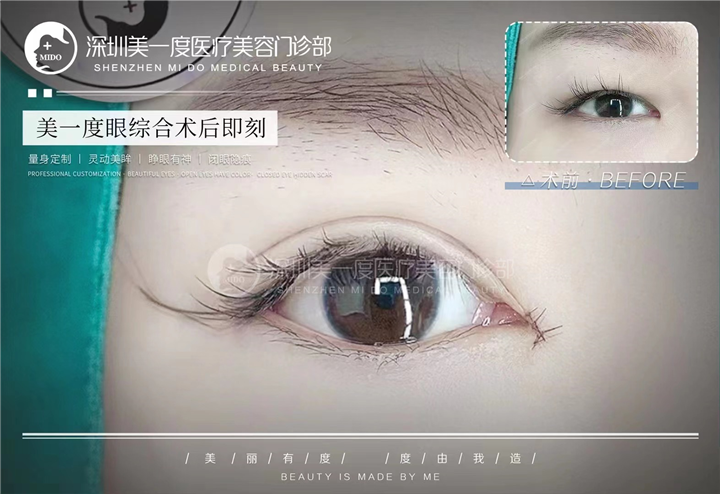 深圳高级脸打造