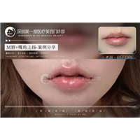 深圳星美度整形