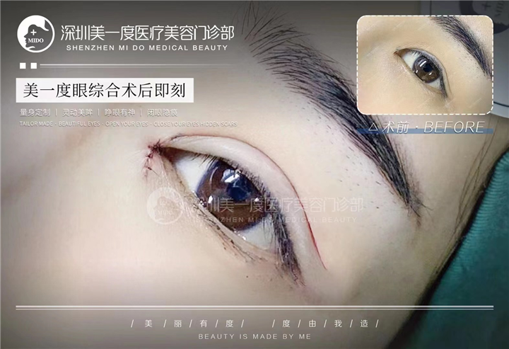 深圳高级脸打造