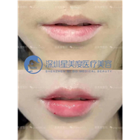 深圳星美度整形