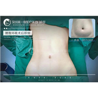 詹娜芝