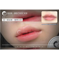 深圳星美度整形