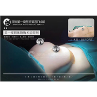 深圳星美度整形