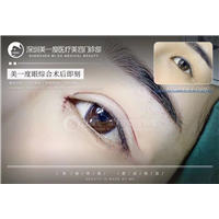 深圳高级脸打造