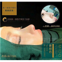 深圳超肋鼻综合整形