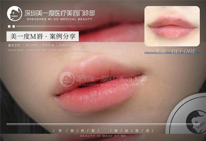 深圳星美度整形