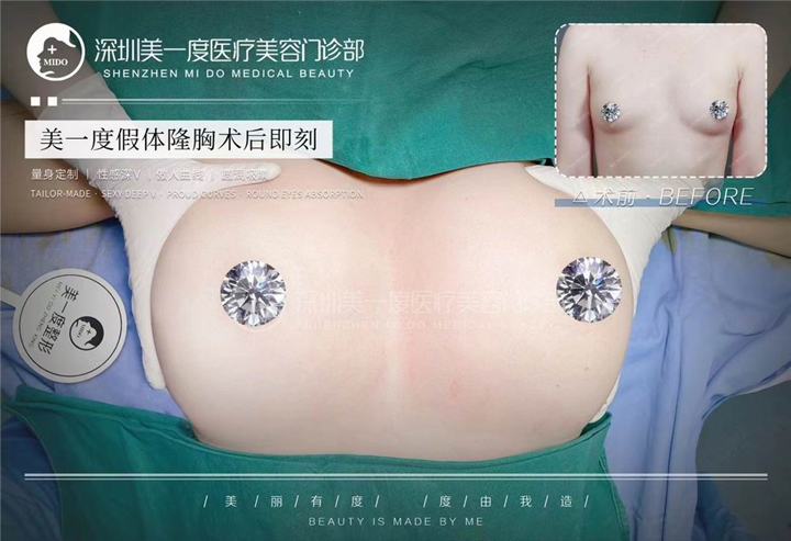 深圳星美度整形