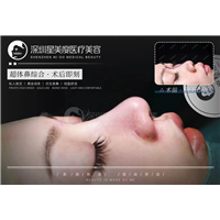 深圳超肋鼻综合整形