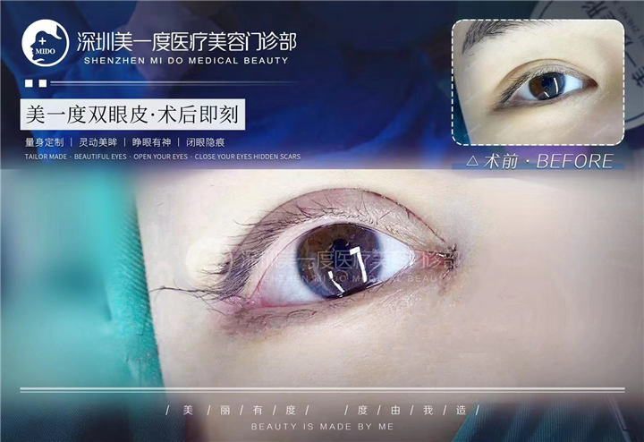 深圳高级脸打造