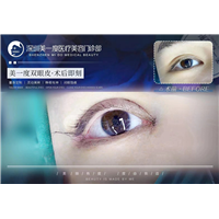 深圳高级脸打造