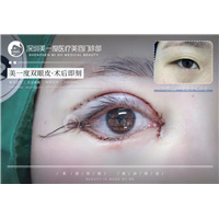 深圳高级脸打造