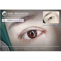 深圳高级脸打造