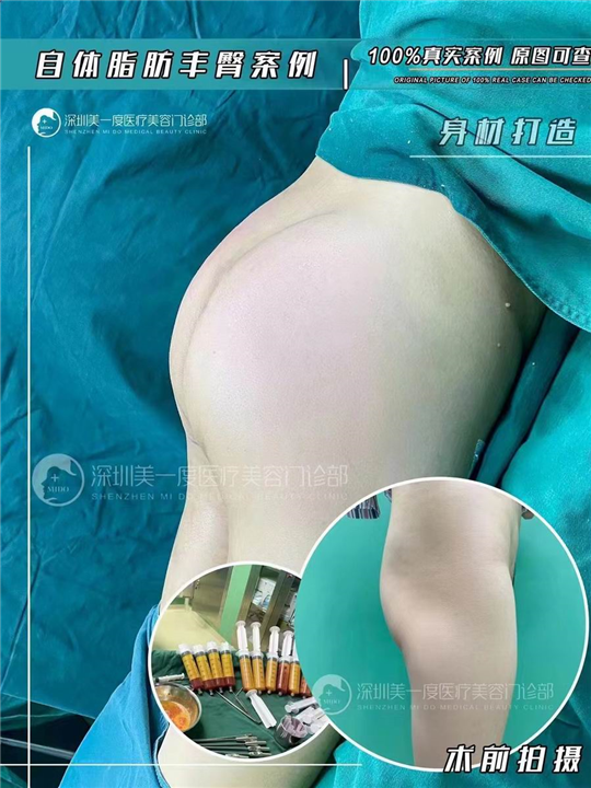 星美度整形创始人