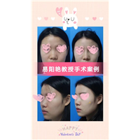 易阳艳医生做鼻子怎么样
