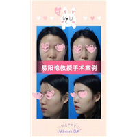 南昌易阳艳医生做鼻子怎么样