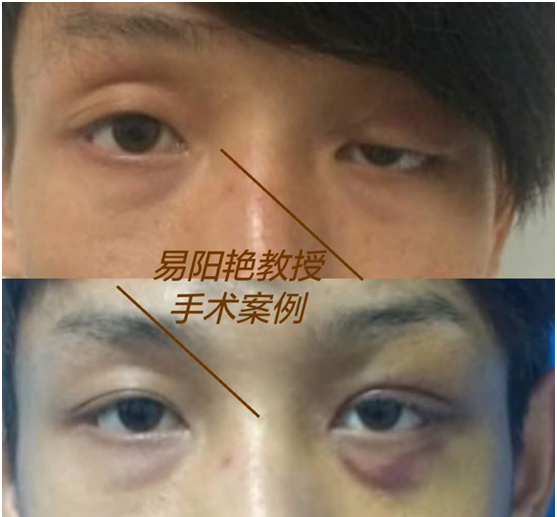 南昌易阳艳医生