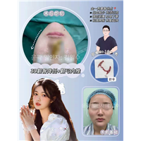 上海金一秀磨骨专家 