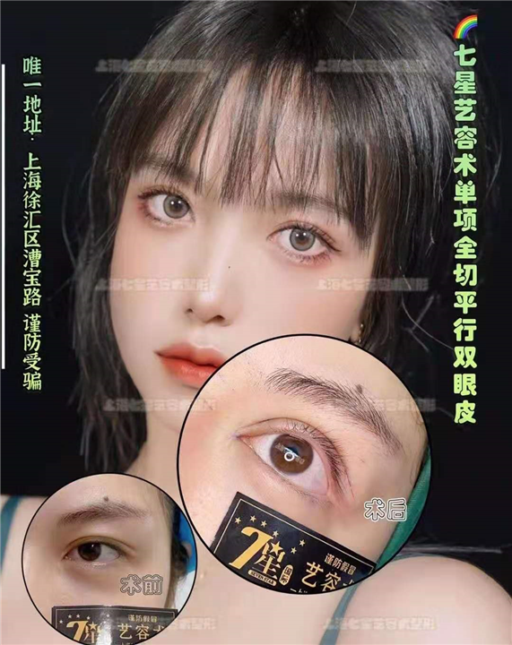 上海七星眼综合整形价格多少 