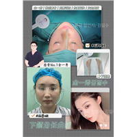 上海金一秀磨骨价格 