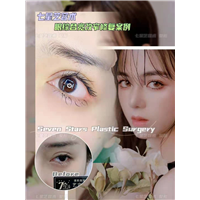 上海七星艺容术眼综合术后 