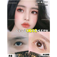 上海七星艺容术双眼皮案例 
